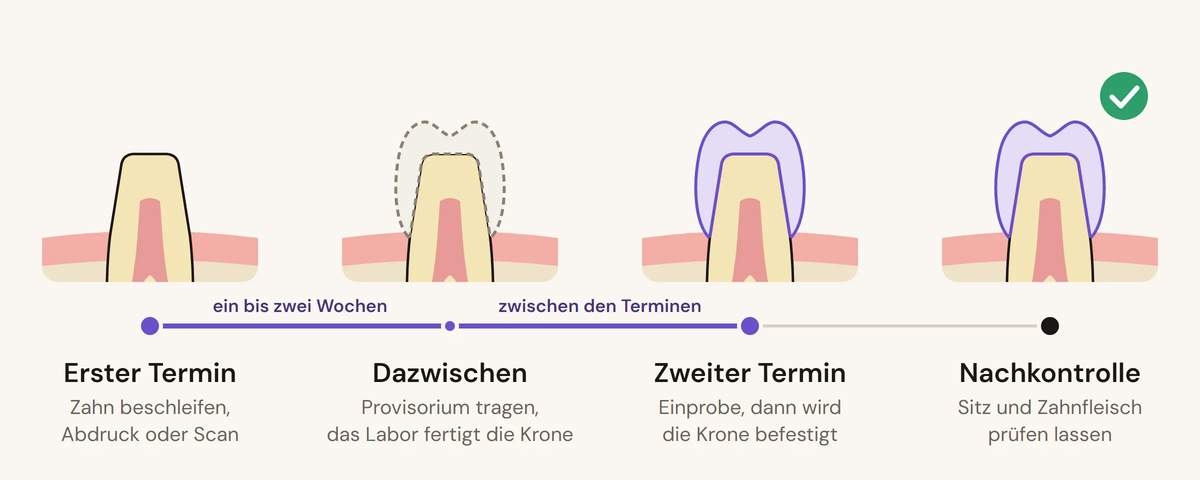 Zeitstrahl einer Kronenbehandlung: erster Termin mit beschliffenem Zahn, Provisorium in der Zwischenzeit, zweiter Termin mit der definitiven Krone, danach die Nachkontrolle.